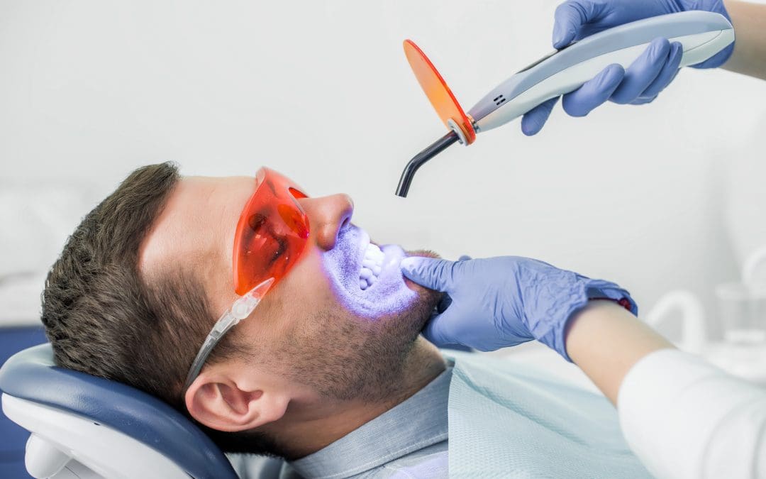 Emergency Teeth Whitening Service: Quick Boosts Before Big Moments