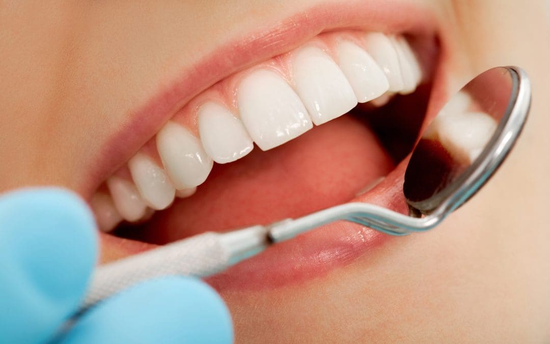 Best Type of Dental Bridge for Front Teeth: A Complete Guide